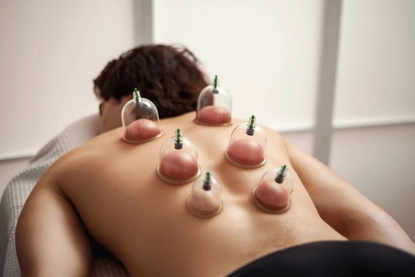 vacuum-cups-therapy-wellness-cupping-600nw-2494343815